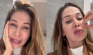 Aos 42 anos, Maíra Cardi expõe deformações no rosto após procedimento estético e risco de paralisia: 'Eu fui enganada'.