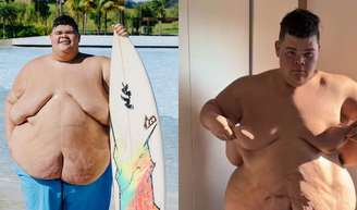 Gordão da XJ choca web ao compartilhar antes e depois do corpo após perder 130 kg; veja antes e depois em 20 fotos!.