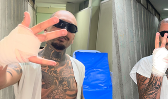 O posicionamento oficial do Rock in Rio sobre streamer que perdeu um dedo ao pular grade em área restrita.