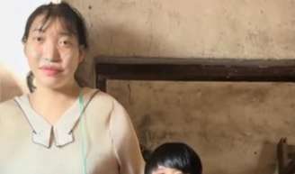 Casamento marcado por 53 cm de diferença: morre aos 26 anos influenciadora chinesa com 2,18m de altura que viralizou por relação com homem mais baixo; Xiao Yue teve diagnóstico de tumor na hipófise e um meningioma.