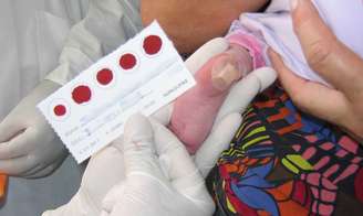 A pesquisa utilizou a mesma gota de sangue no papel filtro coletada para a triagem neonatal, chamada de teste do pezinho. Os bebês não passam por nenhum procedimento diferente do habitual.