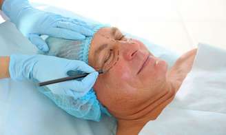 Facelift: cirurgia promove rejuvenescimento facial -