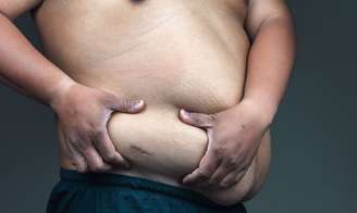10 mudanças que a obesidade causa no corpo e como combatê