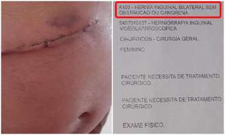 Em vez da retirada da hérnia (como mostra encaminhamento na foto), Assis Fernandes foi submetido a uma cirurgia de vesícula