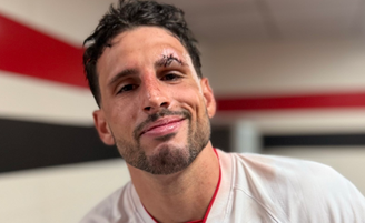 Calleri leva 8 pontos na sobrancelha após choque em São Paulo x Cruzeiro