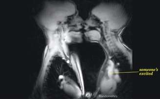 <p>O beijo visto pela máquina de ressonância magnética</p>