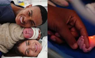 Bebê herdou genética do pai e nasceu com um dedo a mais em cada mão