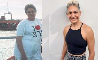 Shyy compartilha seu antes e depois nas redes sociais.