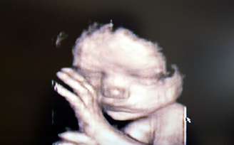 Imagem em 3D mostra bebê no útero da mãe