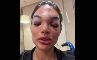 A cirurgiã-dentista Giullia Falcão afirma ter sido agredida pelo marido, o empresário Ivo Kos.