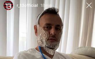 Rafinha publicou imagem com máscara após o procedimento cirúrgico (Foto: Reprodução/Instagram)