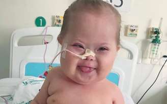 Foto de um bebê com síndrome de down em um hospital