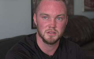 Jovem quase morre por infecção após estourar espinha no pescoço