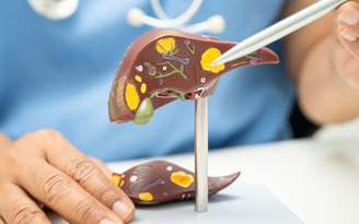 O perigo para o fígado não está só nas frituras: o excesso de açúcar e farinhas brancas também pode causar acúmulo de gordura. /