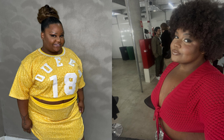 Mc Carol, antes e depois da lipo de papada
