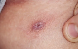 tomczykbartek/gettyimages