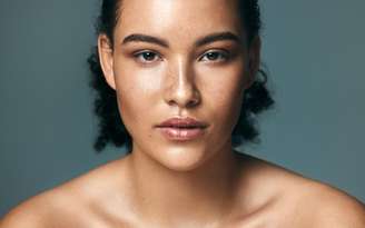 Veja qual a influência do estresse no melasma