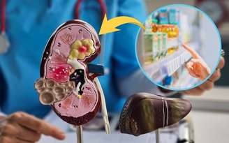 O consumo frequente de produtos com esse ingrediente pode causar acúmulo de gordura e prejudicar a função do fígado. /