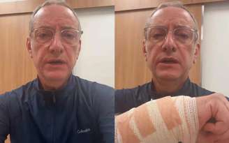 Jornalista precisou de quatro pontos na mão