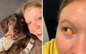 Esfregar os olhos
