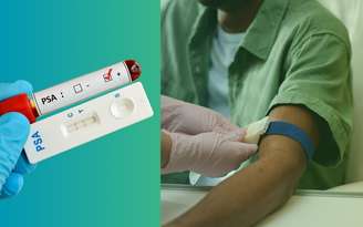Exame de sangue para próstata / Canva
