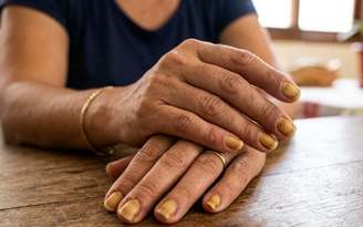 Unhas amareladas