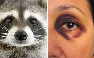 Olhos de guaxinim