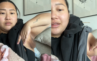 Jasmine desenvolveu um terceiro mamilo na axila