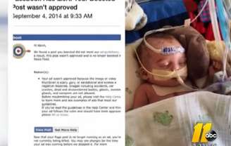 Hudson tem um problema grave no coração e precisa de um transplante