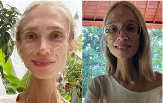 Mulher chegou a pesar somente 22 quilos