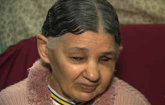 Dona Maria da Glória perdeu um globo ocular após a operação