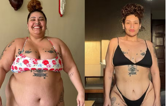 Ex-The Voice mostra cicatrizes de abdominoplastia após perder 90 kg: 'Coragem de ser eu mesma'