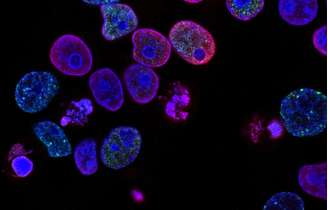 Cientistas rastrearam proteínas que ajuda câncer a se espalhar