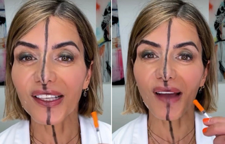 Esteticista americana Bita Farrell aplica botox em apenas um lado do rosto para mostrar efeitos
