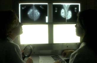 Médicas analisam mamografia