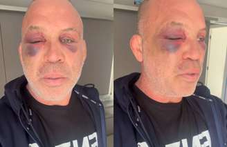 Wanderlei Silva em vídeo publicado nas redes sociais