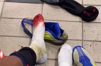 Yamal leva a pior em lance contra o Las Palmas – Florencia Tan Jun/Getty Images