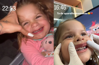 Maria Flor mostra como ficou aparelho de contenção dentária