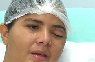 Luan Silva da Costa foi agredido com um palito de churrasco no olho esquerdo