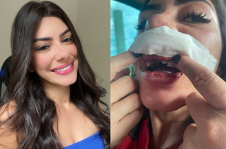 Kaline Milena foi agredida pelo companheiro, o cantor Diego Damasceno