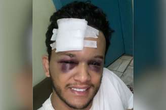 Hugo sofreu um acidente na volta de um show no Mato Grosso do Sul