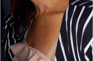 Suspeito tentou enforcar vítima com pano e ácido