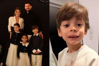 Enrico, filho de Marquinhos e Carol Cabrino sofreu uma queda em casa e cortou a boca