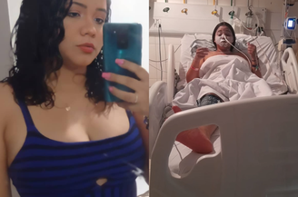 Andressiane Costa perdeu 95% da visão após crise alérgica e descobriu síndrome rara no Piauí 