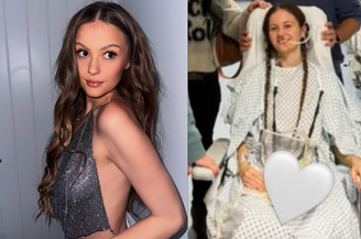 Após quatro meses longe das redes sociais, influenciadora Holly Hubert reaparece e revela coma