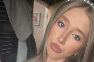 Samantha Redding teve parte do lábio superior arrancado no ataque