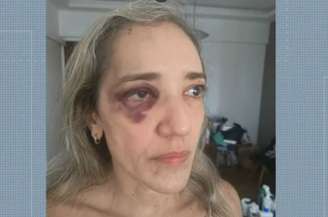 Ana Cristina Durão Nunes foi agredida por motociclista de aplicativo 