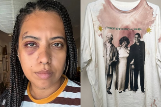 Influencer Carla Lemos é agredida em roda de samba no Rio
