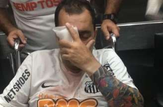 Torcedor perdeu o olho direito após ser atingido por uma suposta bala de borracha