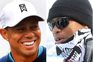 Tiger Woods fez cirurgia para recuperar dentes
